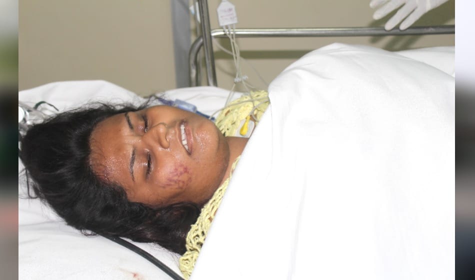 Fire pipe burst, female scorching 