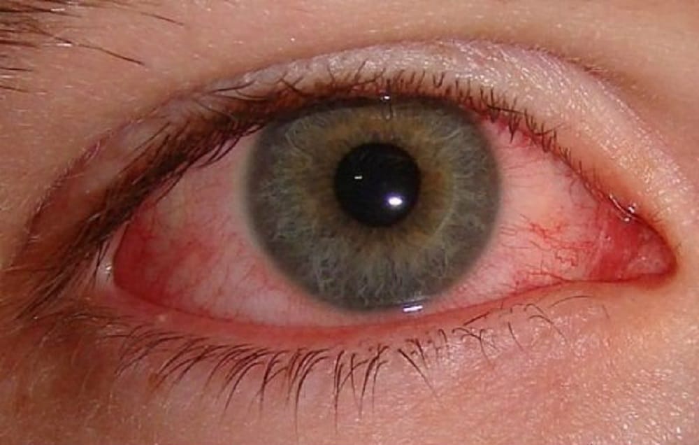 These Bizzare Eyes make you feel horrible