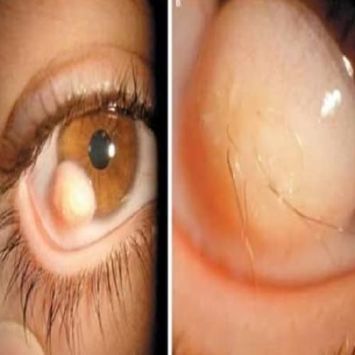 These Bizzare Eyes make you feel horrible