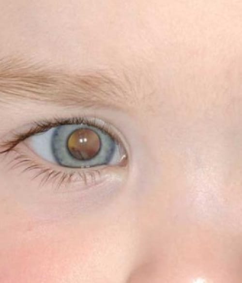 These Bizzare Eyes make you feel horrible