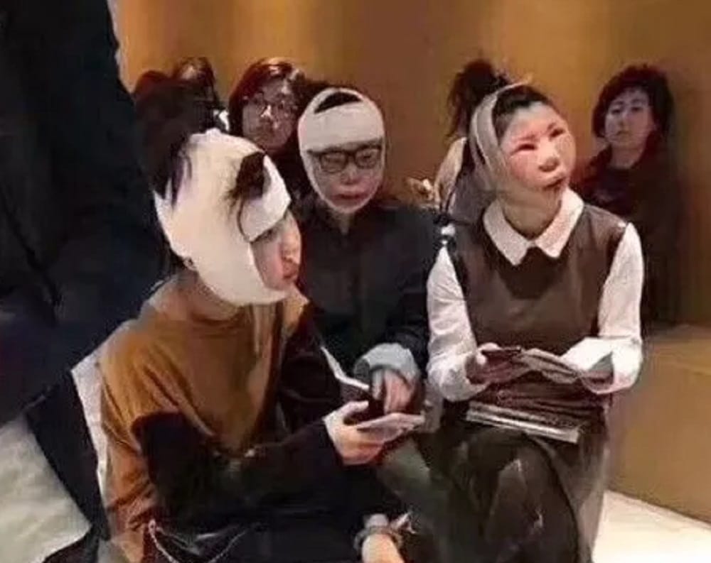 Chinese Women questioning At Airport After unidentifiable Plastic Surgery