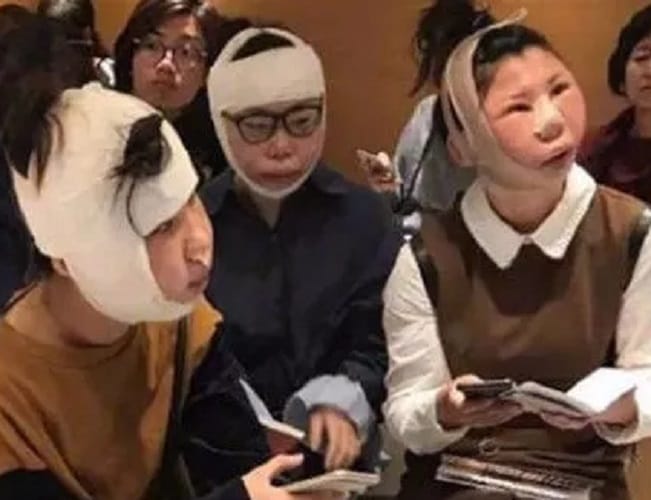 Chinese Women questioning At Airport After unidentifiable Plastic Surgery