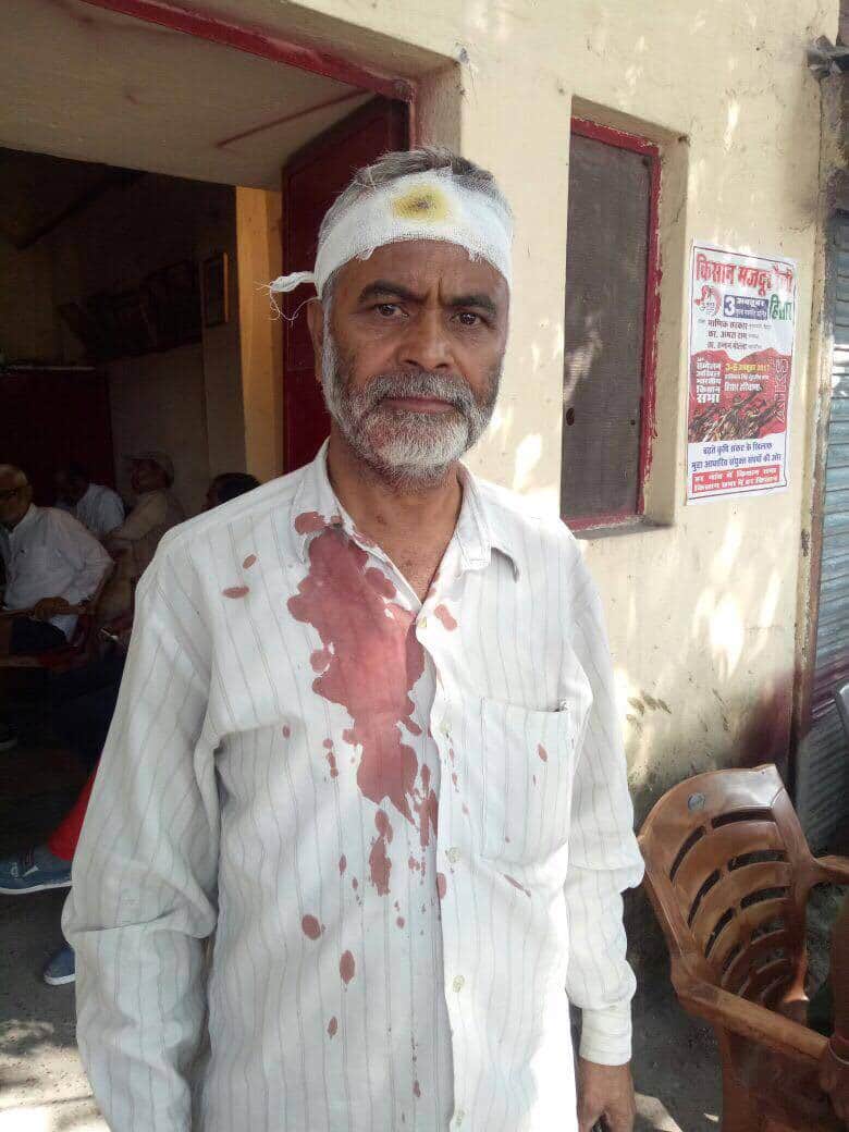 vampanthi leader injured in bjp protest