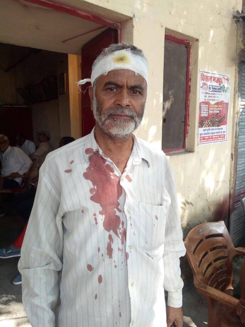 vampanthi leader injured in bjp protest