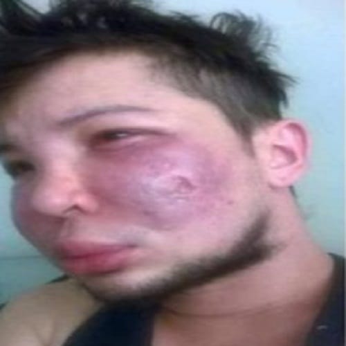 plastic surgery may leave bad impact on your face 
