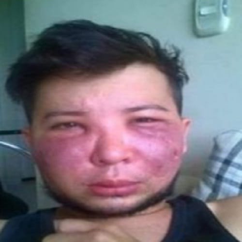 plastic surgery may leave bad impact on your face 
