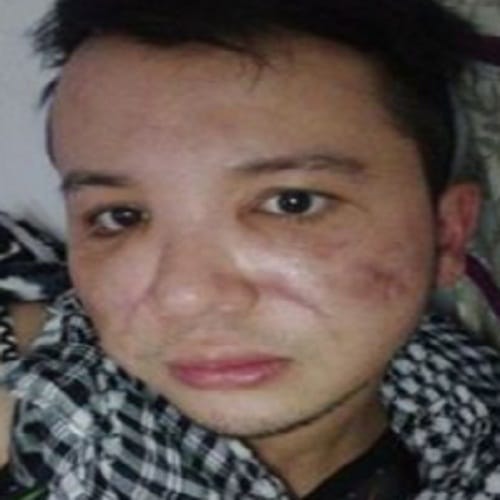 plastic surgery may leave bad impact on your face 