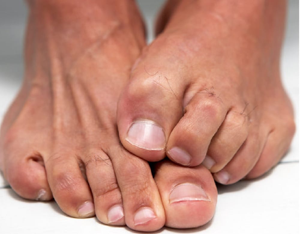 It can be dangerous for health to wear shoes without socks