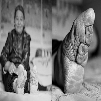 on the name of beautiful foot China follows footbinding tradition in 20th century 