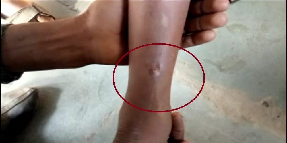 Nailed to the foot of child for confessed crime