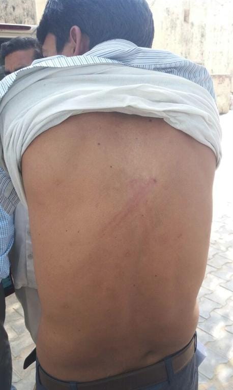 Junior Engineer Beaten during Checking