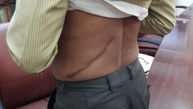 bjp minister husband may be involved in kidney racket