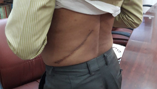 bjp minister husband may be involved in kidney racket