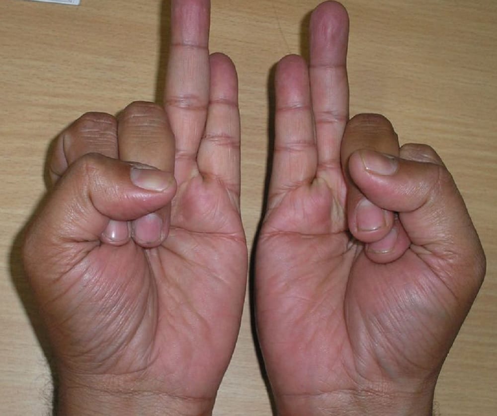If you are suffering from back pain then practice kati mudra daily 