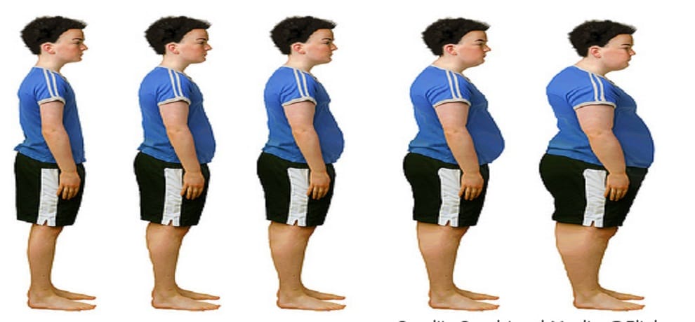 Tenfold increase in childhood and adolescent obesity in four decades says study