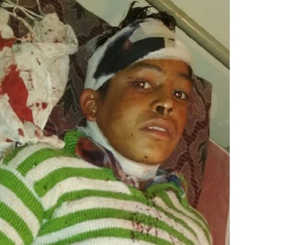 Dabang attacked father-son and injured him