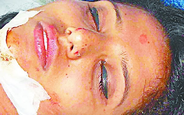 13 injured in road accident