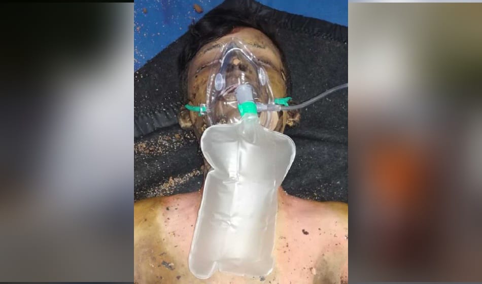 man committed suicide by burning himself at india gate