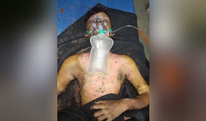 man committed suicide by burning himself at india gate