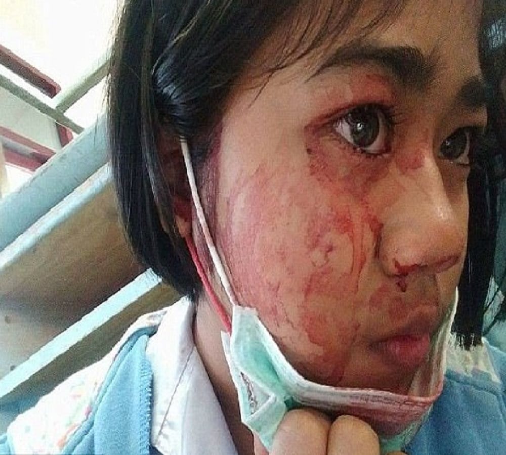 blood sweating of this woman from italy 