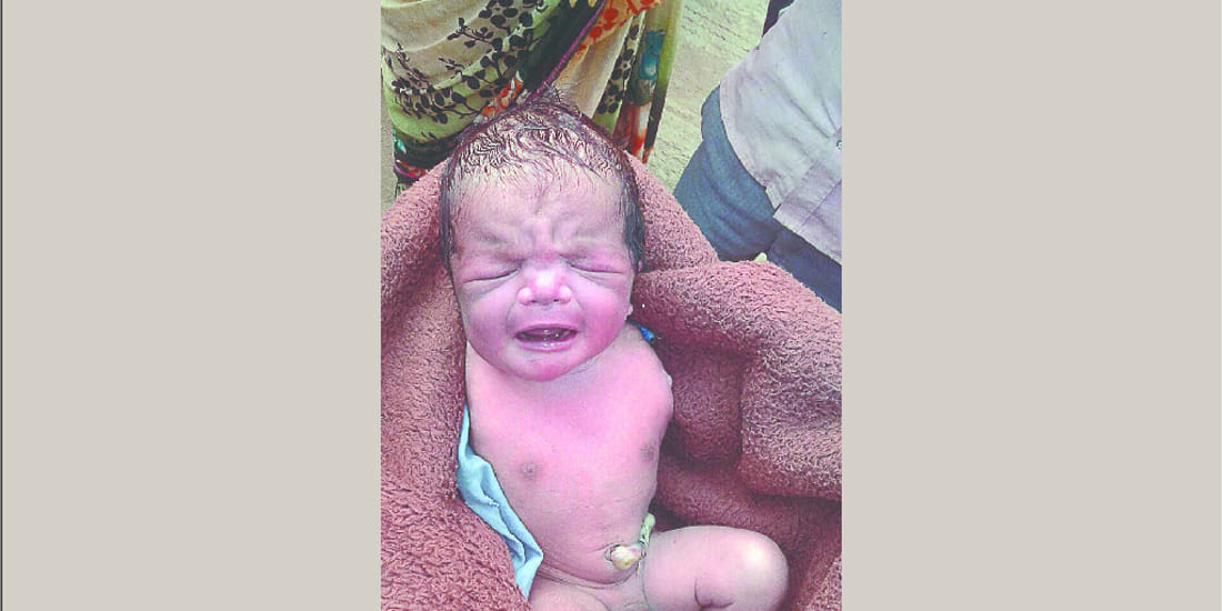 Newborn without arms CMO says it is such a rare case