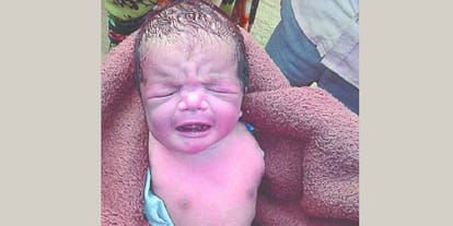 Newborn without arms CMO says it is such a rare case