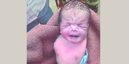Newborn without arms CMO says it is such a rare case