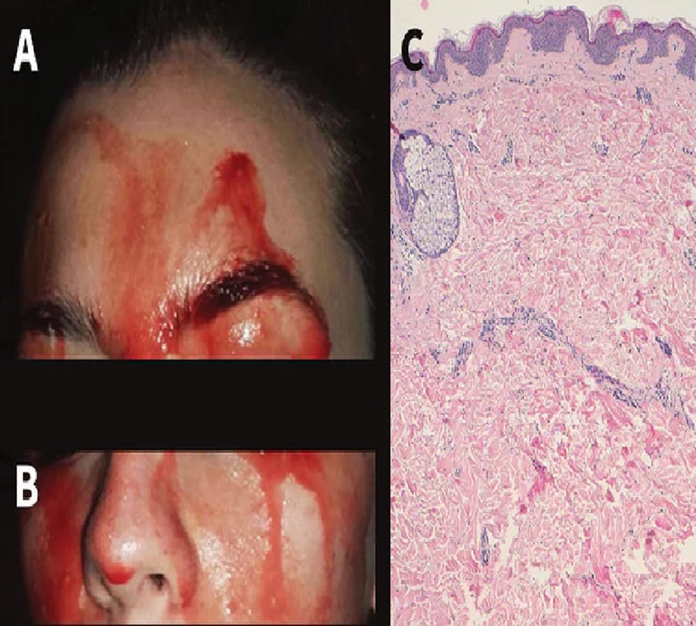 blood sweating of this woman from italy 