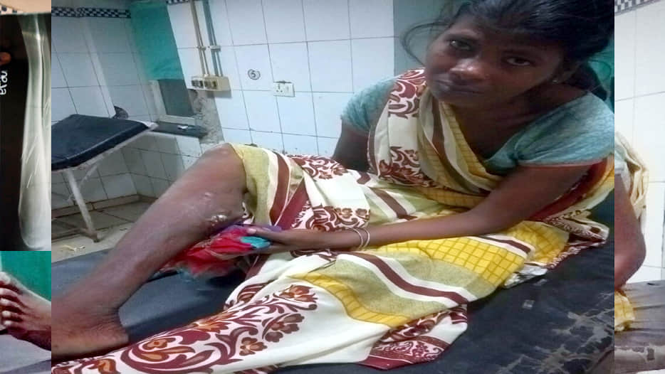 Iron nail Getting out from legs