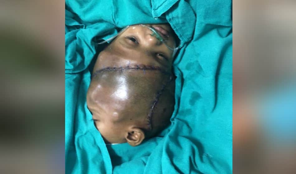 after the surgery of twins jagga came out from the ventilator but balia is still fainted