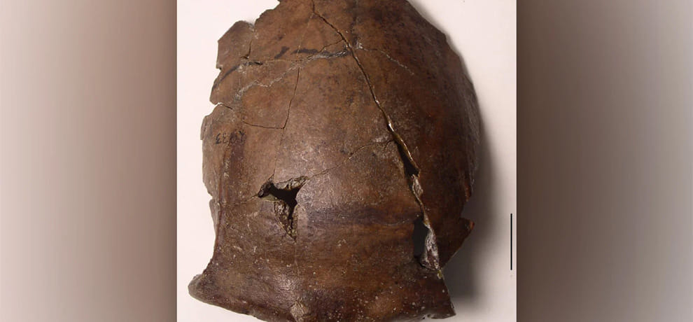  6000-Year-Old Skull Could Be The Earliest Known Tsunami Victim