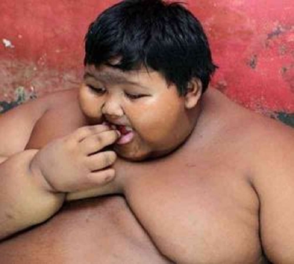 world fattest child who is around two hundred kilogram
