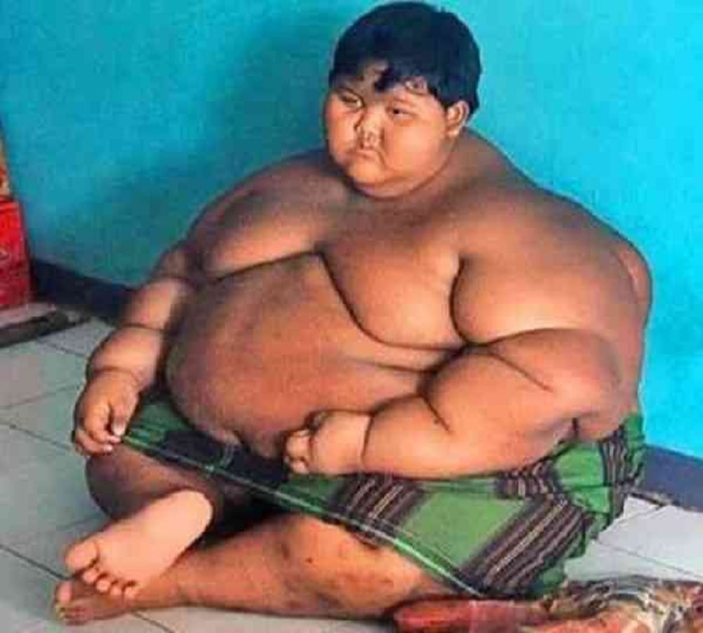 world fattest child who is around two hundred kilogram