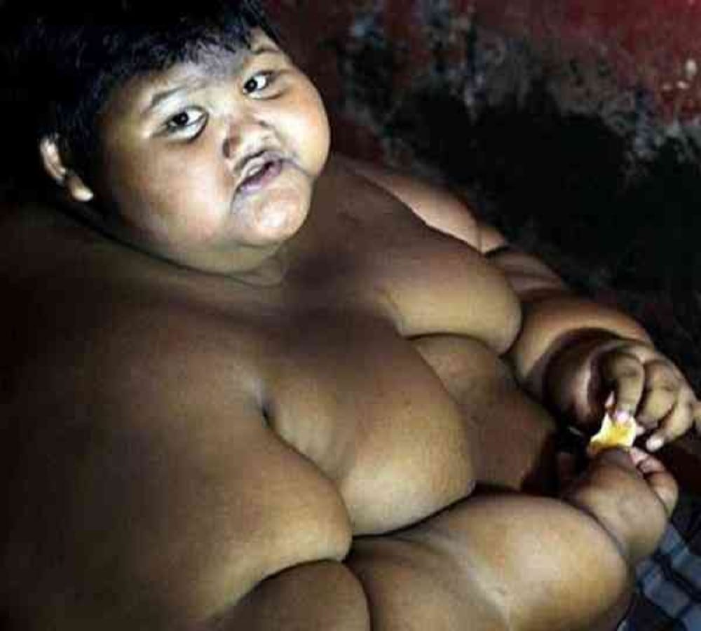 world fattest child who is around two hundred kilogram