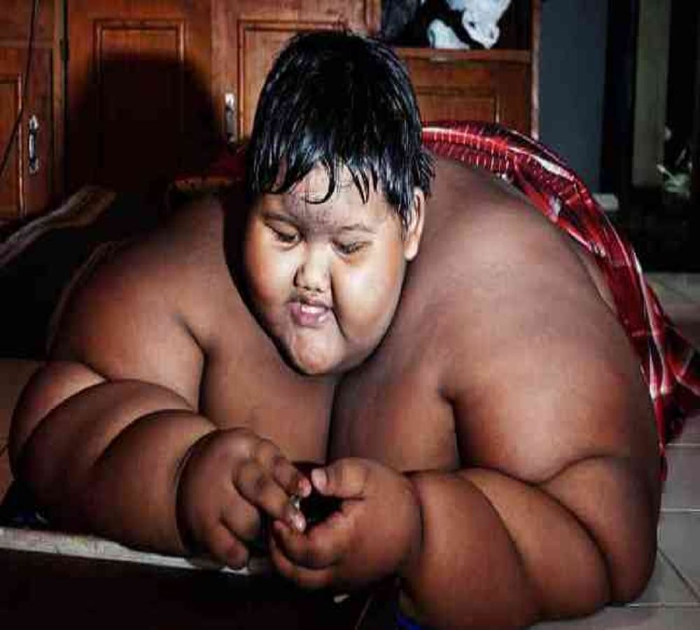 world fattest child who is around two hundred kilogram