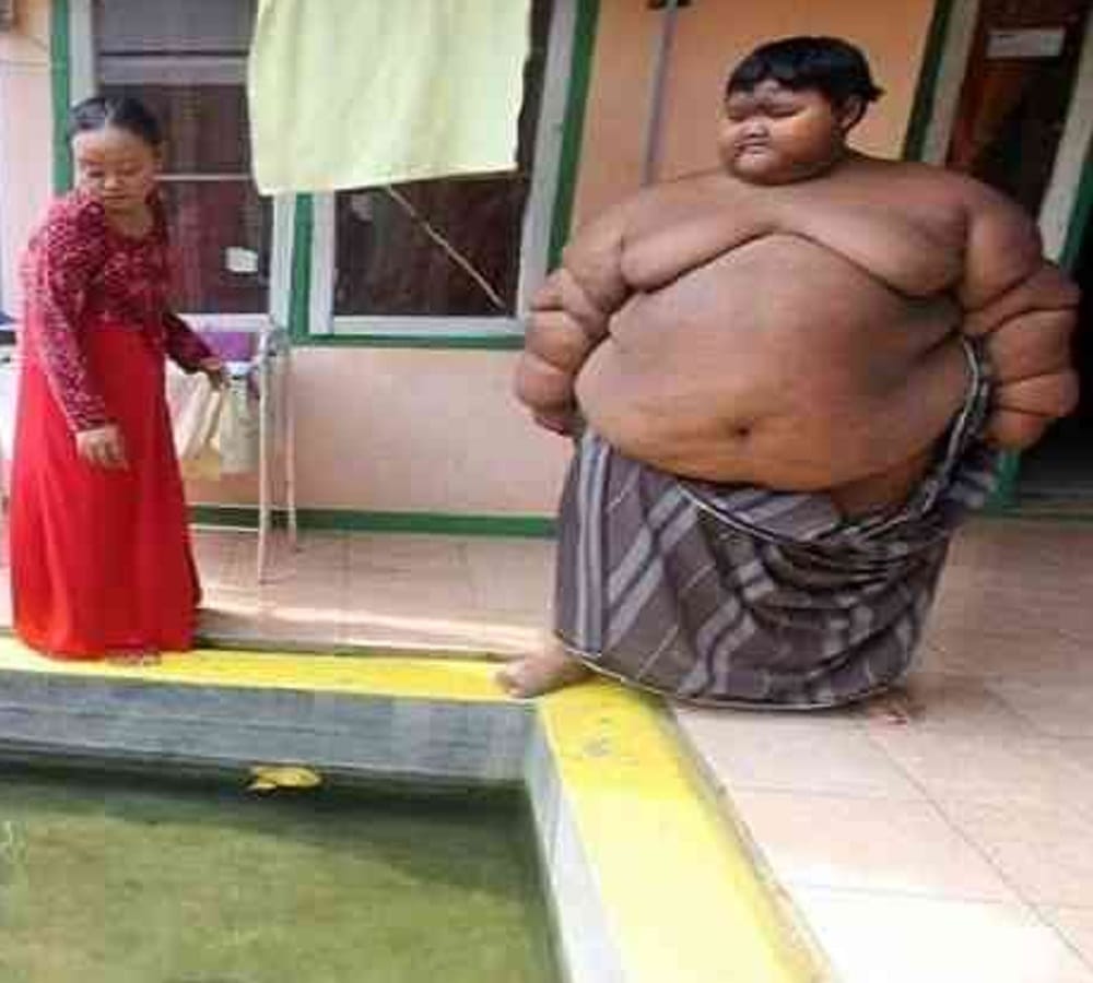 world fattest child who is around two hundred kilogram