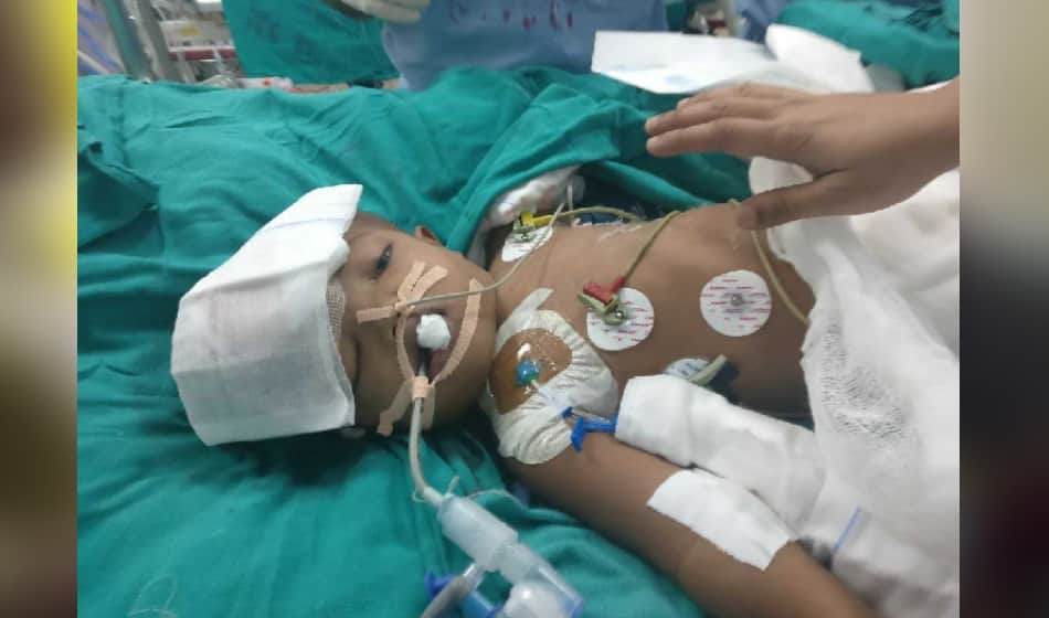 in jagga balia operation case balia got skin on his head after two hours surgery 