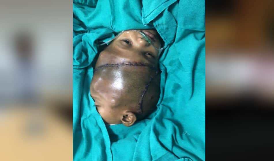 in jagga balia operation case balia got skin on his head after two hours surgery 