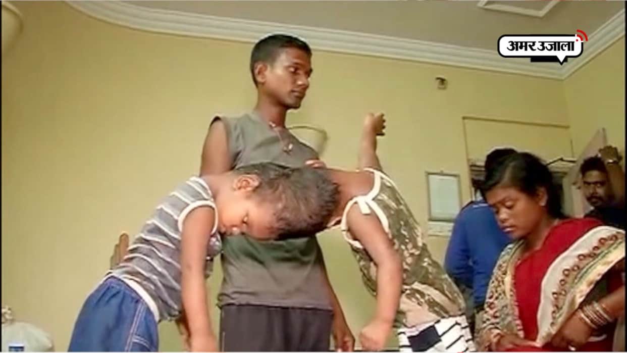 after the surgery of twins jagga came out from the ventilator but balia is still fainted