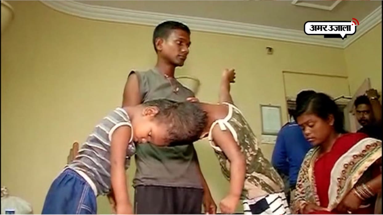 after the surgery of twins jagga came out from the ventilator but balia is still fainted
