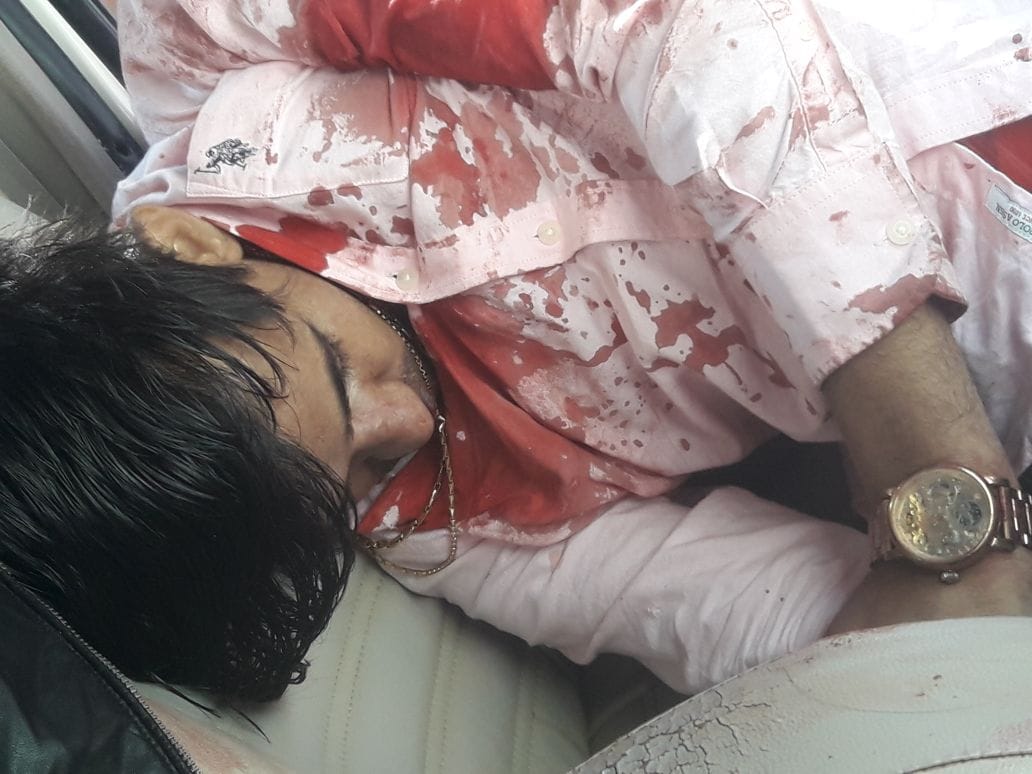 In a ancounter by police a boy killed by shot gun in rajasthan