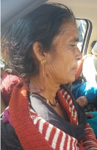 Leopard attacked woman 