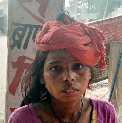 पानी के विवाद में युवती का सिर फोड़ा