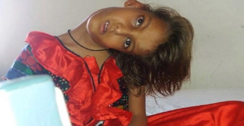 this Pakistani girl suffering from rare medical disorder neck bent into 90 degree angle 