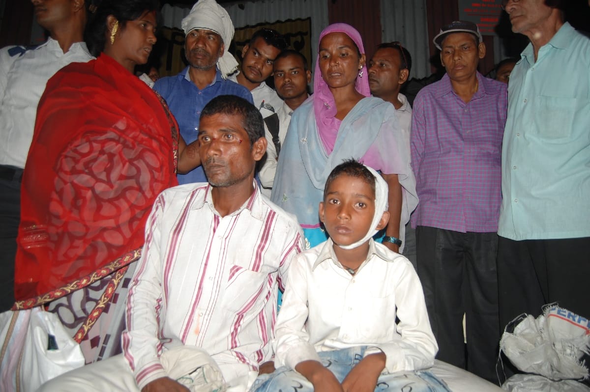 मालगाड़ी का अर्थ बॉड टूटा, पिता-पुत्र घायल