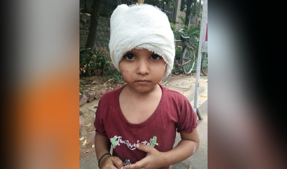 video gone viral of a girl, ears were cut in the operation