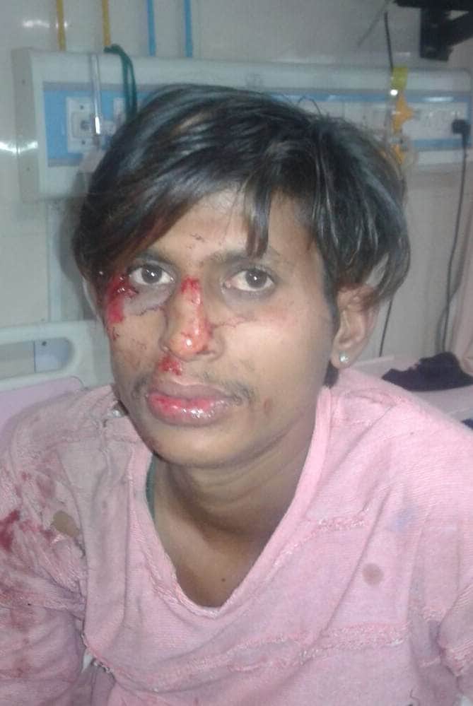 Uncontrollable dumper crushed many people