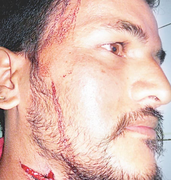 Leopard attacked traveller in Bhilkot