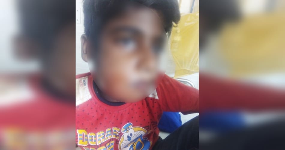 Student badly beaten by her class teacher in Indira Colony