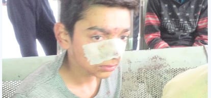  injured school children statement on bus accident in agra